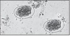 HOOKWORM EGGS.